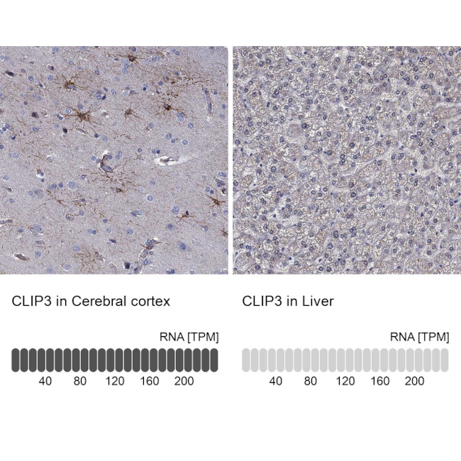 CLIP3 Antibody in Immunohistochemistry (Paraffin) (IHC (P))