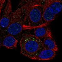 QPRT Antibody in Immunocytochemistry (ICC/IF)