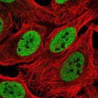 INO80 Antibody in Immunocytochemistry (ICC/IF)