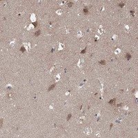 LPCAT4 Antibody in Immunohistochemistry (Paraffin) (IHC (P))