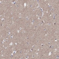 Dematin Antibody in Immunohistochemistry (Paraffin) (IHC (P))