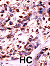 UCK2 Antibody in Immunohistochemistry (Paraffin) (IHC (P))