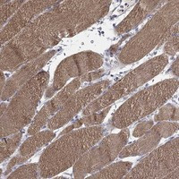 IP6K3 Antibody in Immunohistochemistry (Paraffin) (IHC (P))