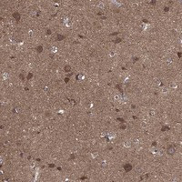 BMERB1 Antibody in Immunohistochemistry (Paraffin) (IHC (P))