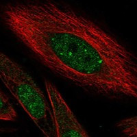 HIVEP1 Antibody in Immunocytochemistry (ICC/IF)