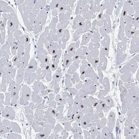 Rbm20 Antibody in Immunohistochemistry (Paraffin) (IHC (P))