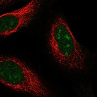 UCK1 Antibody in Immunocytochemistry (ICC/IF)