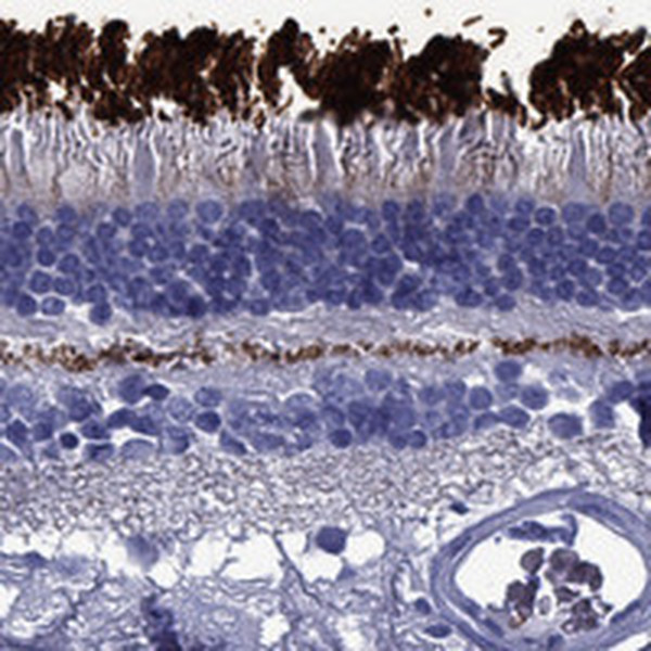 ROM1 Antibody in Immunohistochemistry (Paraffin) (IHC (P))