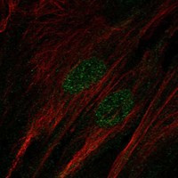 SALL1 Antibody in Immunocytochemistry (ICC/IF)