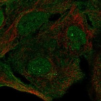 SIPA1L3 Antibody in Immunocytochemistry (ICC/IF)