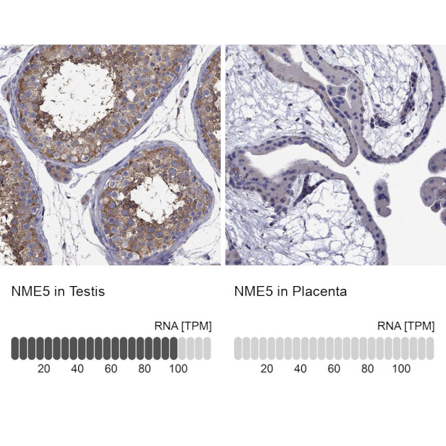 NME5 Antibody in Immunohistochemistry (Paraffin) (IHC (P))