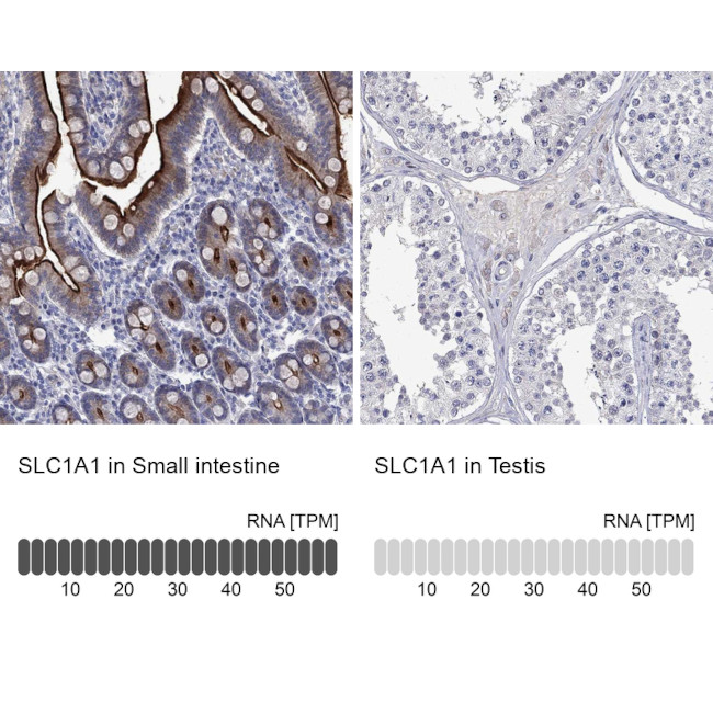 EAAC1 Antibody in Immunohistochemistry (Paraffin) (IHC (P))