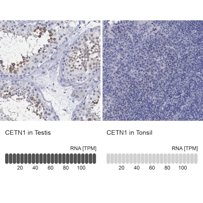 Centrin 1 Antibody in Immunohistochemistry (Paraffin) (IHC (P))