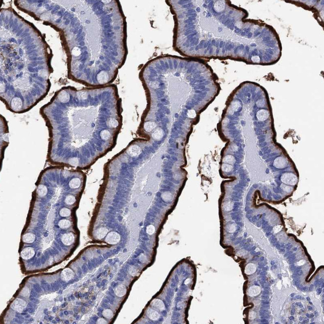 DPP4 Antibody in Immunohistochemistry (Paraffin) (IHC (P))