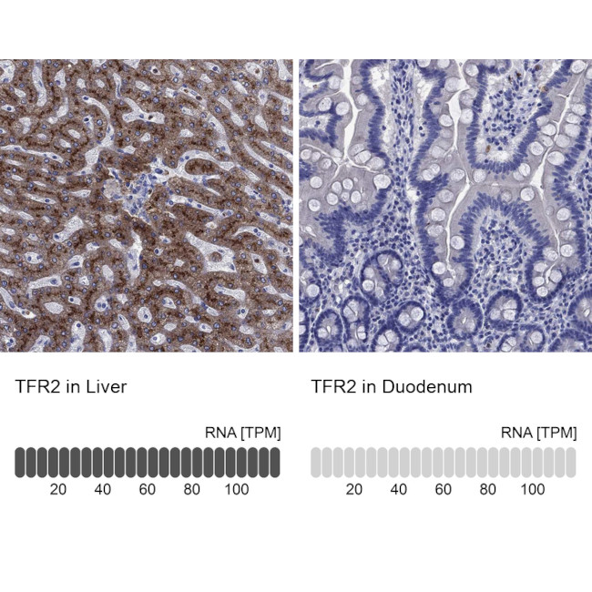 TFR2 Antibody in Immunohistochemistry (Paraffin) (IHC (P))