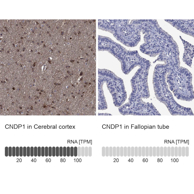 CNDP1 Antibody in Immunohistochemistry (Paraffin) (IHC (P))