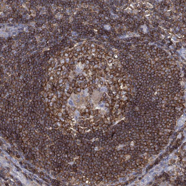 DOCK8 Antibody in Immunohistochemistry (Paraffin) (IHC (P))