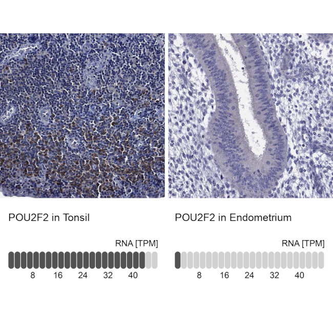 OCT2 Antibody in Immunohistochemistry (Paraffin) (IHC (P))