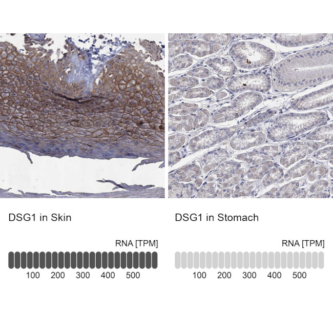 Desmoglein 1 Antibody in Immunohistochemistry (Paraffin) (IHC (P))