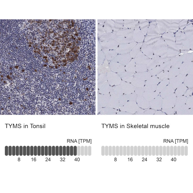 Thymidylate Synthase Antibody in Immunohistochemistry (Paraffin) (IHC (P))