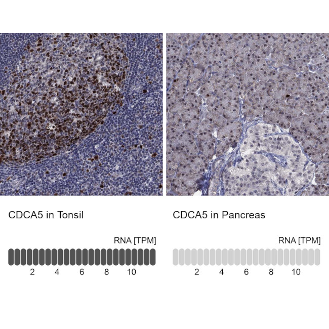 CDCA5 Antibody in Immunohistochemistry (Paraffin) (IHC (P))