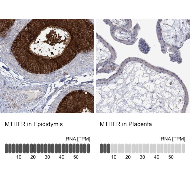 MTHFR Antibody in Immunohistochemistry (Paraffin) (IHC (P))