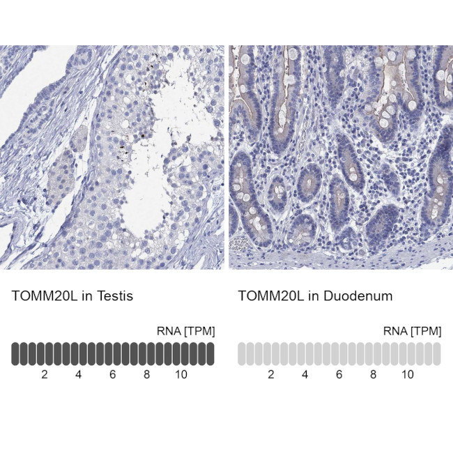 TOMM20L Antibody in Immunohistochemistry (Paraffin) (IHC (P))