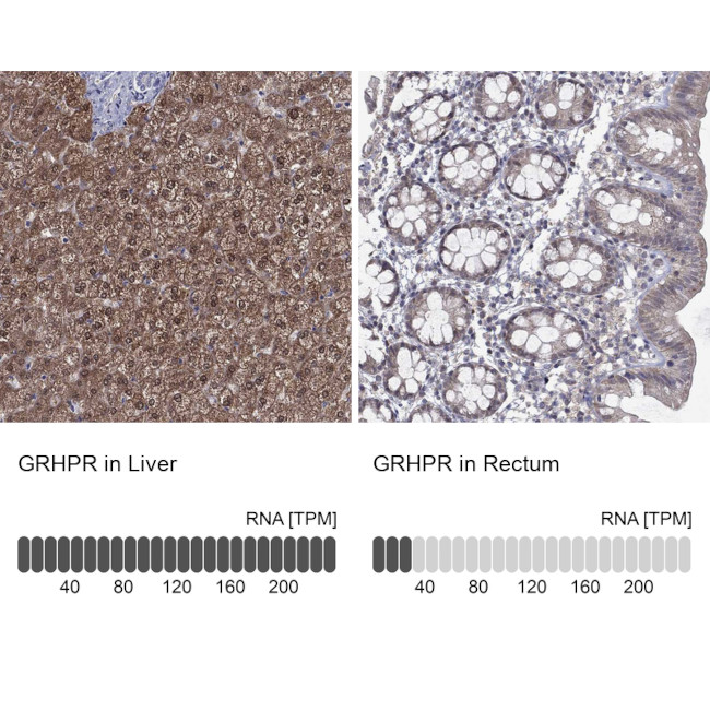 GRHPR Antibody in Immunohistochemistry (Paraffin) (IHC (P))