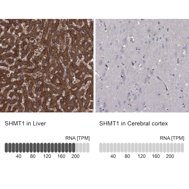 SHMT1 Antibody in Immunohistochemistry (Paraffin) (IHC (P))