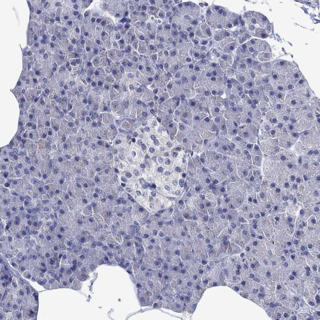 MC2R Antibody in Immunohistochemistry (Paraffin) (IHC (P))