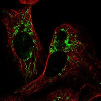 HRASLS3 Antibody in Immunocytochemistry (ICC/IF)