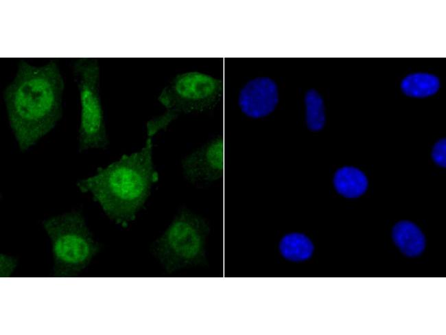 HDAC2 Antibody in Immunocytochemistry (ICC/IF)