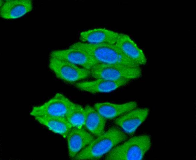 Prohibitin Antibody in Immunocytochemistry (ICC/IF)