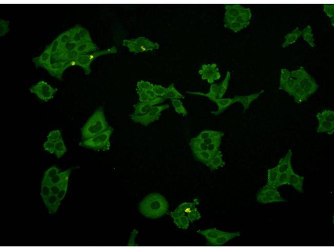 NSE Antibody in Immunocytochemistry (ICC/IF)