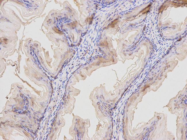 MAL Antibody in Immunohistochemistry (Paraffin) (IHC (P))