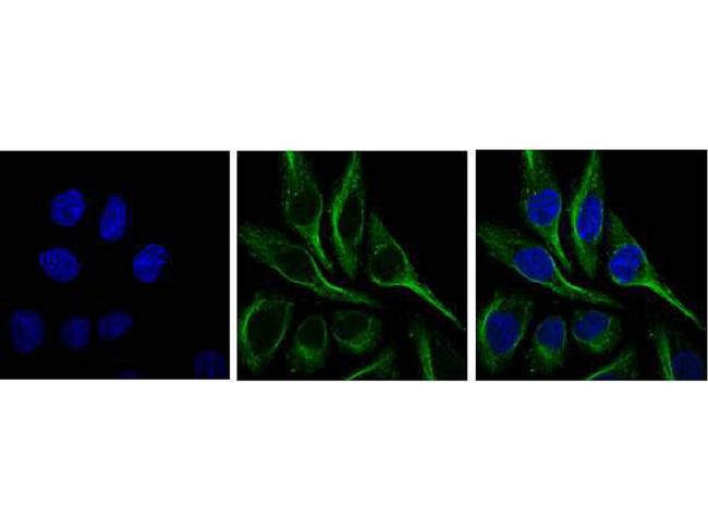 SQSTM1 Antibody in Immunocytochemistry (ICC/IF)