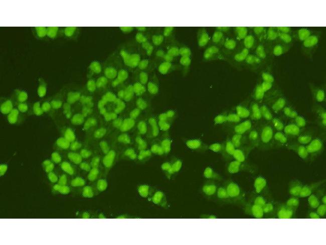 HMGB1 Antibody in Immunocytochemistry (ICC/IF)