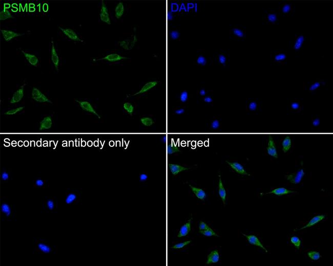 PSMB10 Antibody in Immunocytochemistry (ICC/IF)