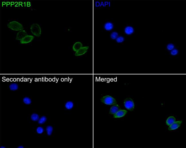 PPP2R1B Antibody in Immunocytochemistry (ICC/IF)