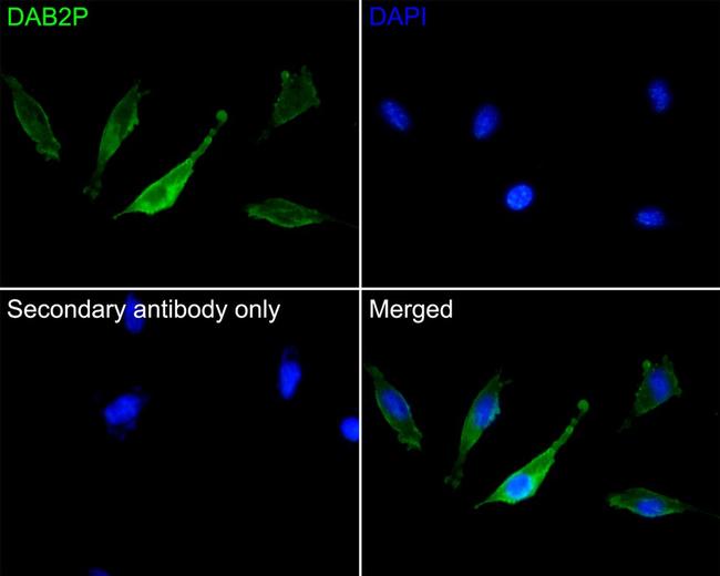 DAB2IP Antibody in Immunocytochemistry (ICC/IF)