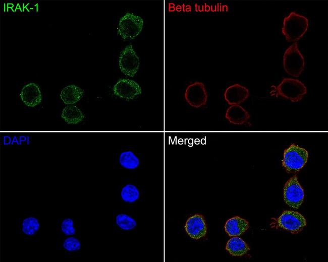 IRAK1 Antibody in Immunocytochemistry (ICC/IF)