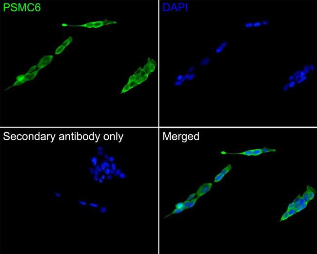 PSMC6 Antibody in Immunocytochemistry (ICC/IF)