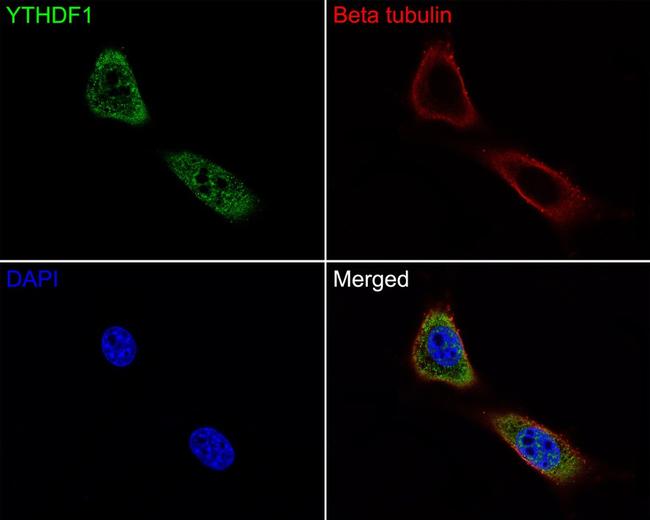 YTHDF1 Antibody in Immunocytochemistry (ICC/IF)