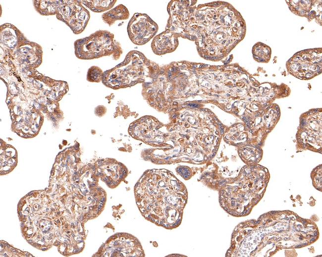 IL12RB1 Antibody in Immunohistochemistry (Paraffin) (IHC (P))