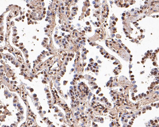 BRG1 Antibody in Immunohistochemistry (Paraffin) (IHC (P))