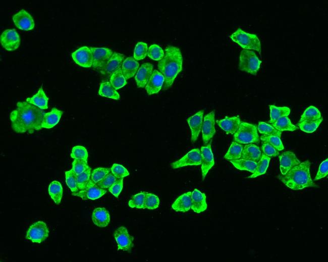 SREBP1 Antibody in Immunocytochemistry (ICC/IF)