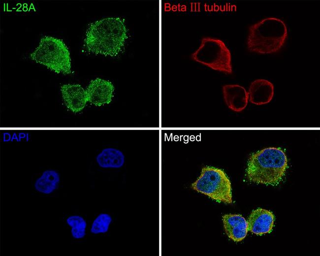 IL-28A Antibody in Immunocytochemistry (ICC/IF)