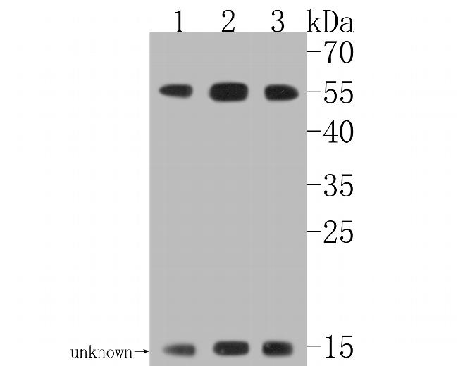 RAD52 Antibody in Western Blot (WB)