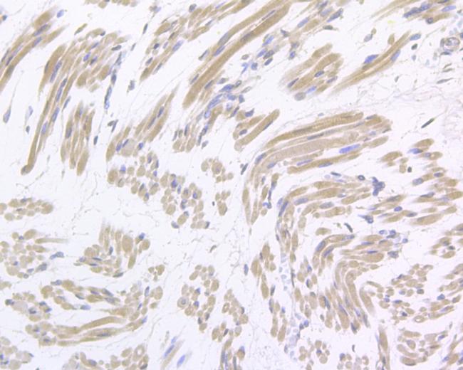 Gemin 2 Antibody in Immunohistochemistry (Paraffin) (IHC (P))