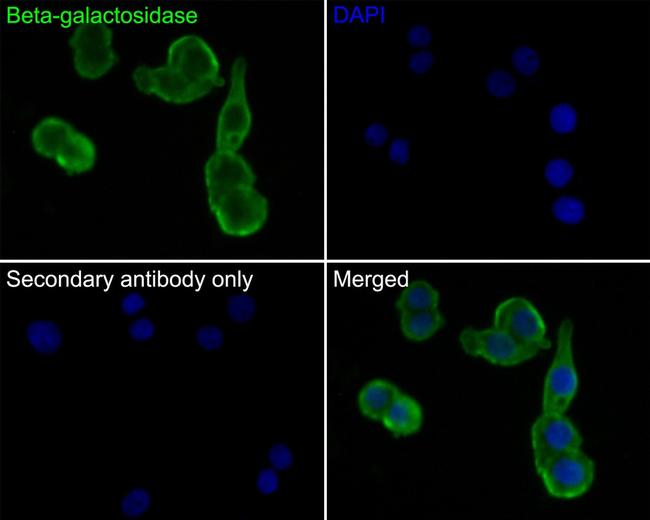 beta Galactosidase Antibody in Immunocytochemistry (ICC/IF)